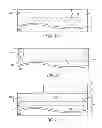 Fig. 02 - Method and structure for body contacted FET with reduced body resistance and source to drain contact leakage