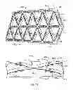 Fig. 08 - High stiffness vibration damping apparatus, methods and systems