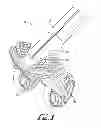 Fig. 02 - FRONT WHEEL ASSEMBLY FOR CHILD SUPPORT DEVICE