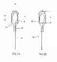 Fig. 03 - High-pressure discharge lamp having an ignition aid