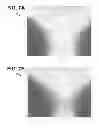 Fig. 06 - Rotational indexing to optimize sensing volume of a nuclear magnetic resonance logging tool