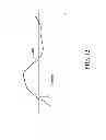 Fig. 16 - Systems and methods for providing sensitive and specific alarms