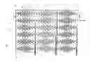 Fig. 01 - TOUCH SENSING PANEL