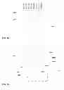 Fig. 15 - Method and apparatus for background subtraction using focus differences