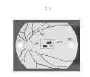Fig. 04 - OPHTHALMOLOGIC APPARATUS AND CONTROL METHOD