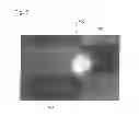 Fig. 08 - Ophthalmologic visualization system