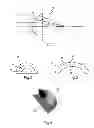Fig. 02 - Optical arrangement for converting an incident light beam, method for converting a light beam to a line focus, and optical device therefor