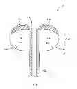 Fig. 02 - Inflatable ear piece and a method of its manufacture