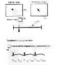 Fig. 01 - List mode dynamic image reconstruction