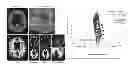 Fig. 01 - Method for improved estimation of tracer uptake in physiological image volumes