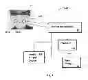Fig. 02 - System and method for detection of speech related acoustic signals by using a laser microphone