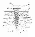 Fig. 01 - ANTI-LOOSE SCREW