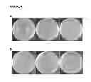 Fig. 07 - Photodynamic Control of Microbial Growth on Surfaces