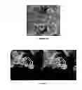 Fig. 06 - NANOPARTICLES FOR IMAGING AND TREATING CHLAMYDIAL INFECTION