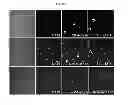Fig. 22 - Process of preparing human multipotent stem cells co-expressing CD34 and CD73