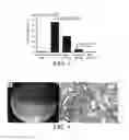 Fig. 04 - Compositions and Methods for Diagnosing and Treating Diabetic Micro Vascular Complications