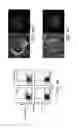 Fig. 09 - Modulation of NKG2D for prolonging survival of a hematopoietic graft