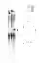 Fig. 03 - Lactic acid bacteria and their use in swine direct-fed microbials