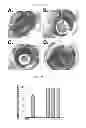 Fig. 03 - Methods for inducing an immune response via buccal and/or sublingual administration of a vaccine