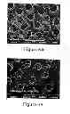 Fig. 07 - Dental Anti-Hypersensitivity Composition and Method