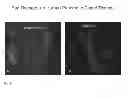 Fig. 09 - Generation of new pancreatic beta cells
