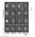 Fig. 29 - TARGETED LIPOSOMES