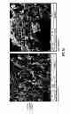Fig. 07 - CORTICOSTEROID PARTICLES AND METHOD OF PRODUCTION