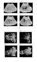 Fig. 03 - Novel milk-fermented product and use thereof