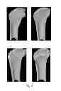 Fig. 04 - Novel milk-fermented product and use thereof