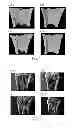 Fig. 05 - Novel milk-fermented product and use thereof