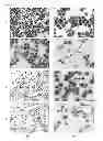 Fig. 12 - Method for the treatment of cancer