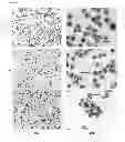 Fig. 13 - Method for the treatment of cancer