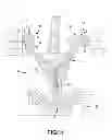 Fig. 02 - Multi-Layered Co-Injection Molded Article