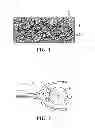Fig. 02 - Non-woven electret fibrous webs and methods of making same