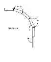 Fig. 32 - Lighter With Flame Director