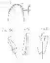 Fig. 03 - Orthodontic Treatment Aligners Based on CT Data