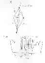 Fig. 04 - Orthodontic Treatment Aligners Based on CT Data