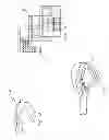 Fig. 02 - DEPTH STOP FOR SURGICAL INSTRUMENTS