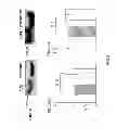 Fig. 06 - Methods and biomarker for evaluating cancer metastasis, pharmaceutical composition for inhibiting cancer metastasis, and method for analyzing secretome