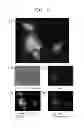 Fig. 03 - Method of sequential and multiple immunostaining for detection of various antigens in the same specimens