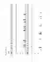 Fig. 06 - Method for direct amplification from crude nucleic acid samples