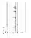 Fig. 10 - Method for direct amplification from crude nucleic acid samples