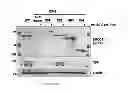 Fig. 08 - EXPRESSION OF ISOFORM 202 OF ERCC1 FOR PREDICTING RESPONSE TO CANCER CHEMOTHERAPY