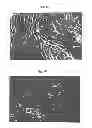 Fig. 02 - SEBOCYTES, SEBOCYTE CELL LINES AND APPLICATIONS THEREOF