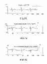 Fig. 06 - ECG measuring device and method thereof