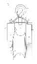 Fig. 01 - PULLEY SYSTEM