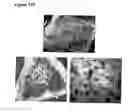Fig. 16 - CUSTOM-MADE MEGANUCLEASE AND USE THEREOF