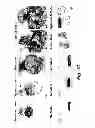 Fig. 03 - METHOD OF DETERMINING THE PROGNOSIS OF HEPATOCELLULAR CARCINOMAS USING A MULTIGENE SIGNATURE ASSOCIATED WITH METASTASIS