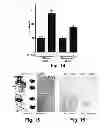Fig. 19 - METHOD OF DETERMINING THE PROGNOSIS OF HEPATOCELLULAR CARCINOMAS USING A MULTIGENE SIGNATURE ASSOCIATED WITH METASTASIS