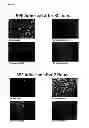 Fig. 06 - Repairing Bruch's membrane with hydrogels
